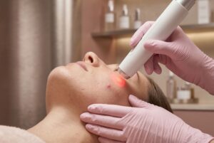 Laserterapia